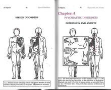 Load image into Gallery viewer, Al-Hijama - Cupping - Healing the Sunnah Way